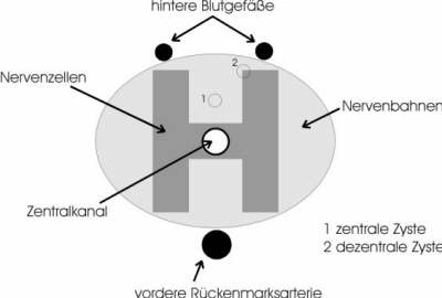 Schema